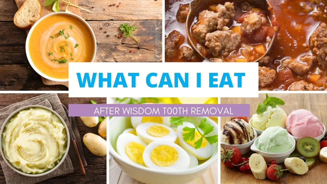 What can you eat after wisdom teeth removal