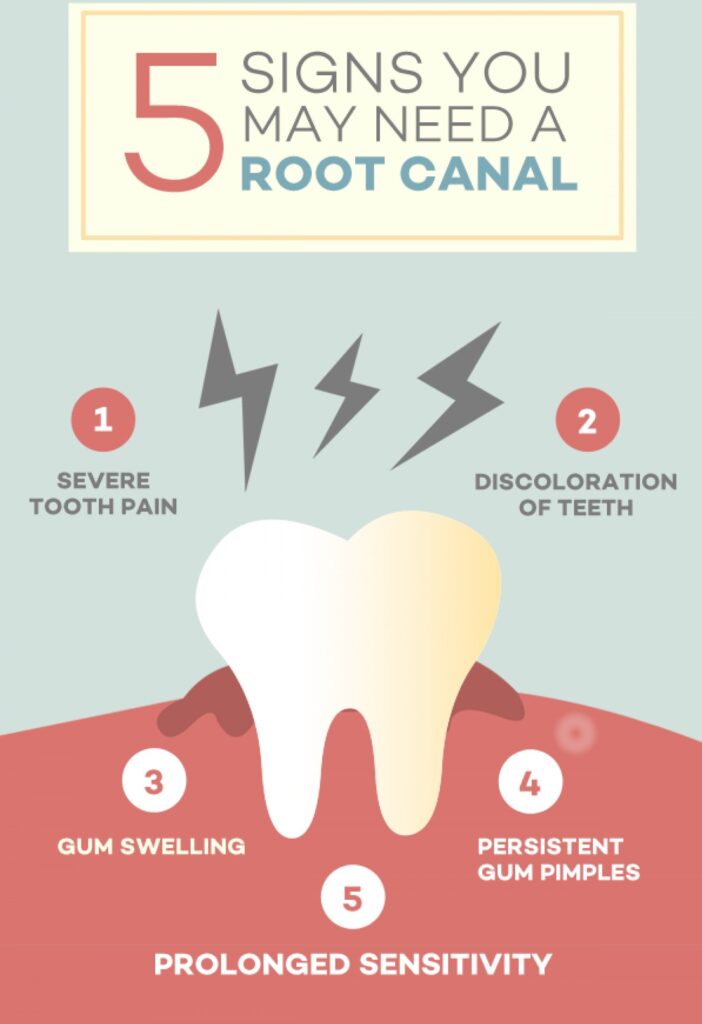 root canal treatment symptoms