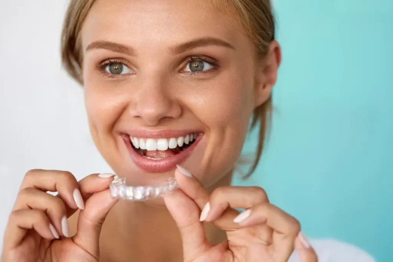Invisalign