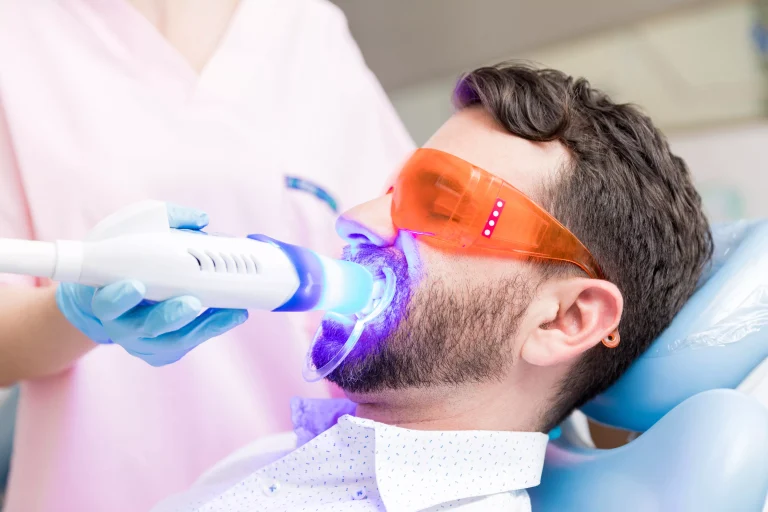 laser teeth whitening