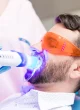 laser teeth whitening laser teeth whitening